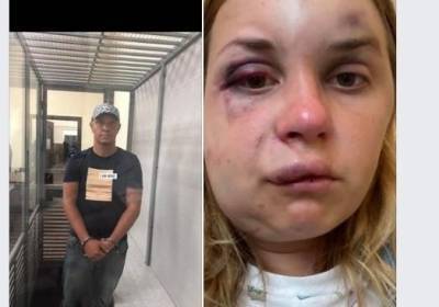 Нападение на журналистку в поезде "Мариуполь - Киев": сестра Рудзько заявила, что у него опухоль в голове