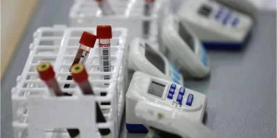 Украина закупит дополнительные полмиллиона тестов на антиген для выявления COVID-19