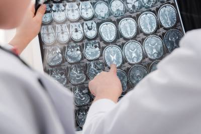 Ученые обнаружили неожиданное лекарство от рака мозга