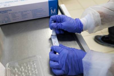 Медик назвал самый быстрый тест на коронавирус