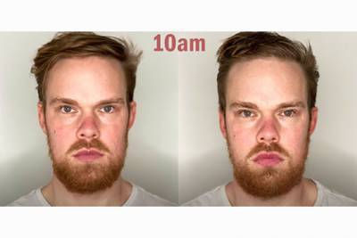 Блогеры выпивали 12 часов подряд и показали негативное влияние алкоголя на лицо