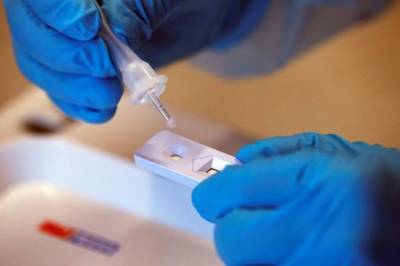 Российские медики сделали свыше 89 млн тестов на коронавирус