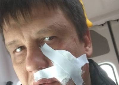 Стрелял директор: водитель в Новосибирске потребовал зарплату и получил пулю в лицо