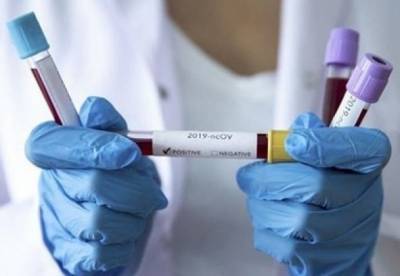 В Украине выявили 4 385 новых случаев коронавируса. Это минимум с начала октября