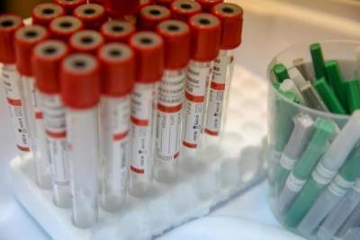Чувашия перешагнула порог в 500 умерших от коронавирусной инфекции