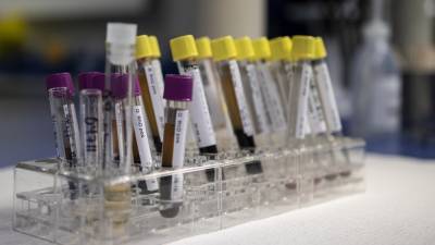 Ученые заявили о влиянии генетики на риск смерти от коронавируса