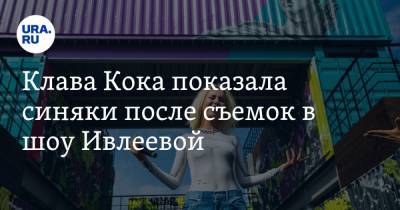 Клава Кока показала синяки после съемок в шоу Ивлеевой. Фото