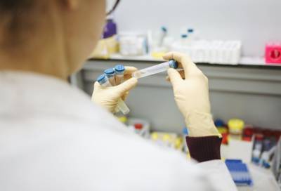 Более 34 тысяч человек в Петербурге сдали тест на коронавирус за минувшие сутки