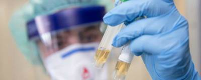 В Оренбургской области обнаружены еще 182 заразившихся коронавирусом