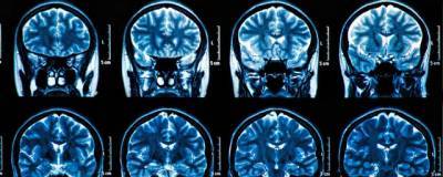 Ученые из США считают, что вирус может нарушать работу мозга