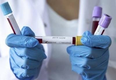 В Украине вновь более 15 тысяч новых случаев коронавируса
