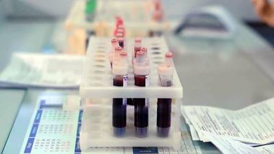 "Царь анализов" – доктор Мясников о показателях общего анализа крови