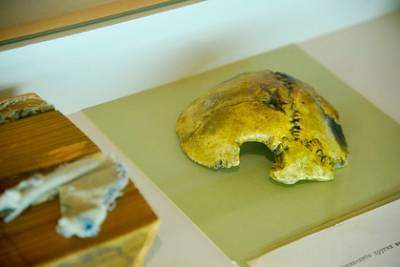 В Москве показали фрагмент черепа Гитлера