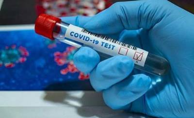 Новые случаи заражения коронавирусом в Тюменской области