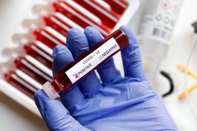 В Ленобласти выявили 215 новых зараженных коронавирусом 6 декабря