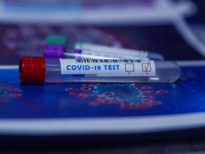 В Украине впервые с августа зафиксировано снижение недельного прироста больных COVID-19 – Минздрав