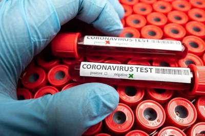 В Чувашии выявили 118 новых заразившихся COVID-19, два человека умерли