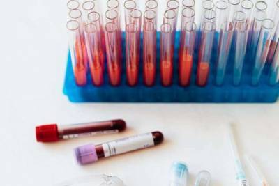О каких болезнях может сообщить общий анализ крови, рассказали врачи