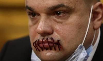 Депутат ЗакСобрания Ленинградской области пришел на заседание с зашитым ртом