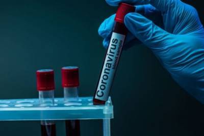За минувшие сутки в Украине выявили 10 811 новых случаев коронавируса, выздоровели - 12 860