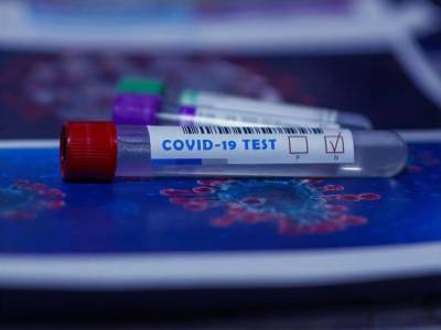 В Украине число тестирований на коронавирус снизилось на 20% – данные Минздрава