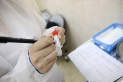 РФ находится в первой тройке стран по тестированию на коронавирус