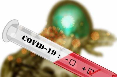 Центр «Вектор» создал экспресс-тест на антитела к COVID-19, выдающий результат через 18 минут