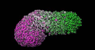Ученые собрали из стволовых клеток модель зародыша человека