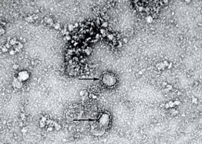 ВОЗ не имеет претензий к России из-за статистики смертей от коронавируса