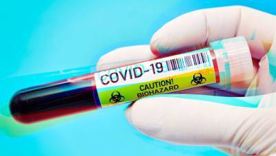 Тестирование на COVID-19 в РФ прошли более 14 млн человек