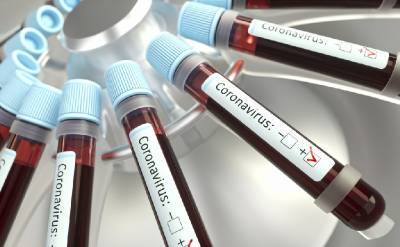 Суточное число заболевших коронавирусом смолян заметно снизилось