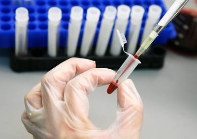 Число зараженных коронавирусом в Чехии достигло 12