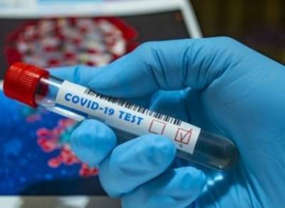 Уже 16004: В Армении за сутки зарегистрировано 723 новых случая заражения коронавирусом