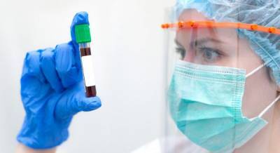 ПЦР-тесты не выявили коронавирус у членов Офиса президента и министров, вернувшихся из Франции