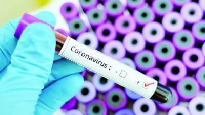 Антирекорд суточной заболеваемости коронавирусом зафиксировали в Донецкой области: 42 новых случая