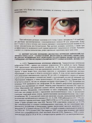 Суд обязал частную клинику выплатить сахалинцу 200 тысяч за проколотый глаз