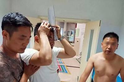 В Китае мужчина с тесаком в голове пришел в больницу