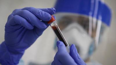 Россия продолжит наращивать тестирование на коронавирус