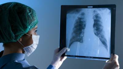 Победить патологию: российские учёные нашли способ восстановления лёгких после COVID-19