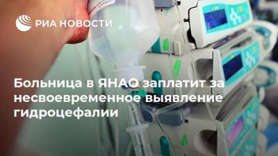 Больница в ЯНАО заплатит за несвоевременное выявление гидроцефалии