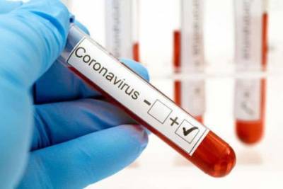 В Украине зафиксировали более 750 новых случае коронавируса