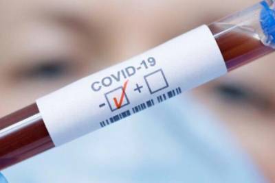 COVID-19: в Чувашии за сутки количество выздоровевших превысило число заболевших