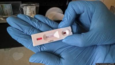 В Украине запускают массовое ИФА-тестирование на коронавирус: в Минздраве назвали причину