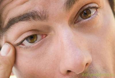 5 симптомов коронавируса в глазах