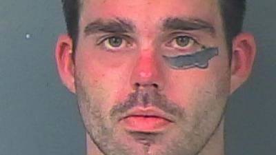 Житель Флориды с татуировкой мачете на лице напал на другого мужчину с мачете