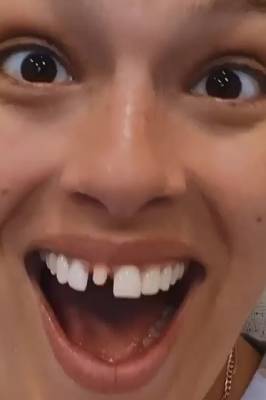 Эшли Грэм развеселила фанатов, показав фото со сломанным зубом