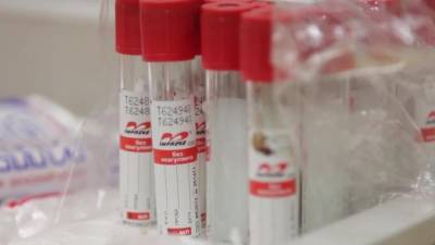 Антитела к коронавирусу обнаружили у 5,7% петербуржцев