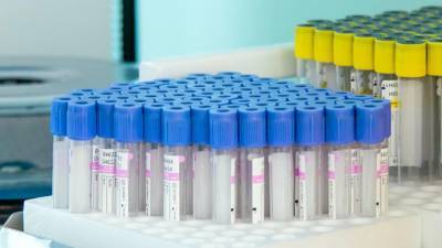 В Подмосковье появилась возможность сдать тест на антитела в поликлиниках