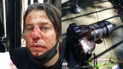 На акции протеста в Лондоне избили итальянского фотожурналиста