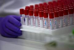 В Минздраве заявили, что первая неделя испытаний вакцины от коронавируса прошла штатно